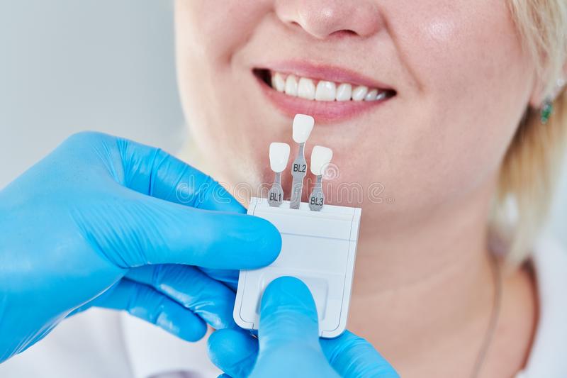 What Are The Benefits Of Cosmetic Dentistry? 