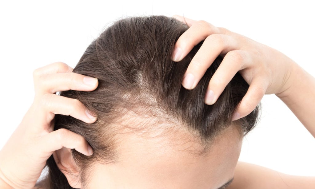 Hair transplant in Dubai, how to choose the best option?