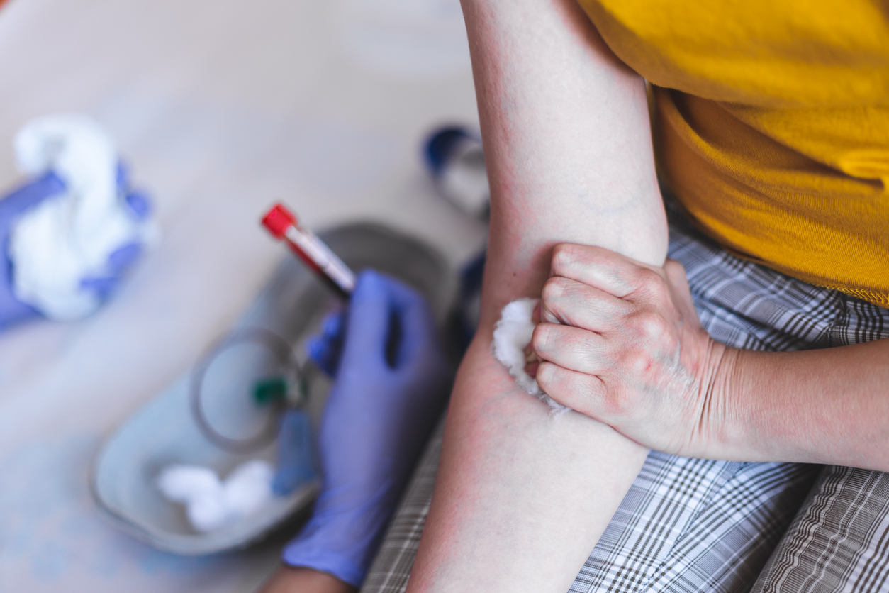 What Happens When You Have a Blood Test?