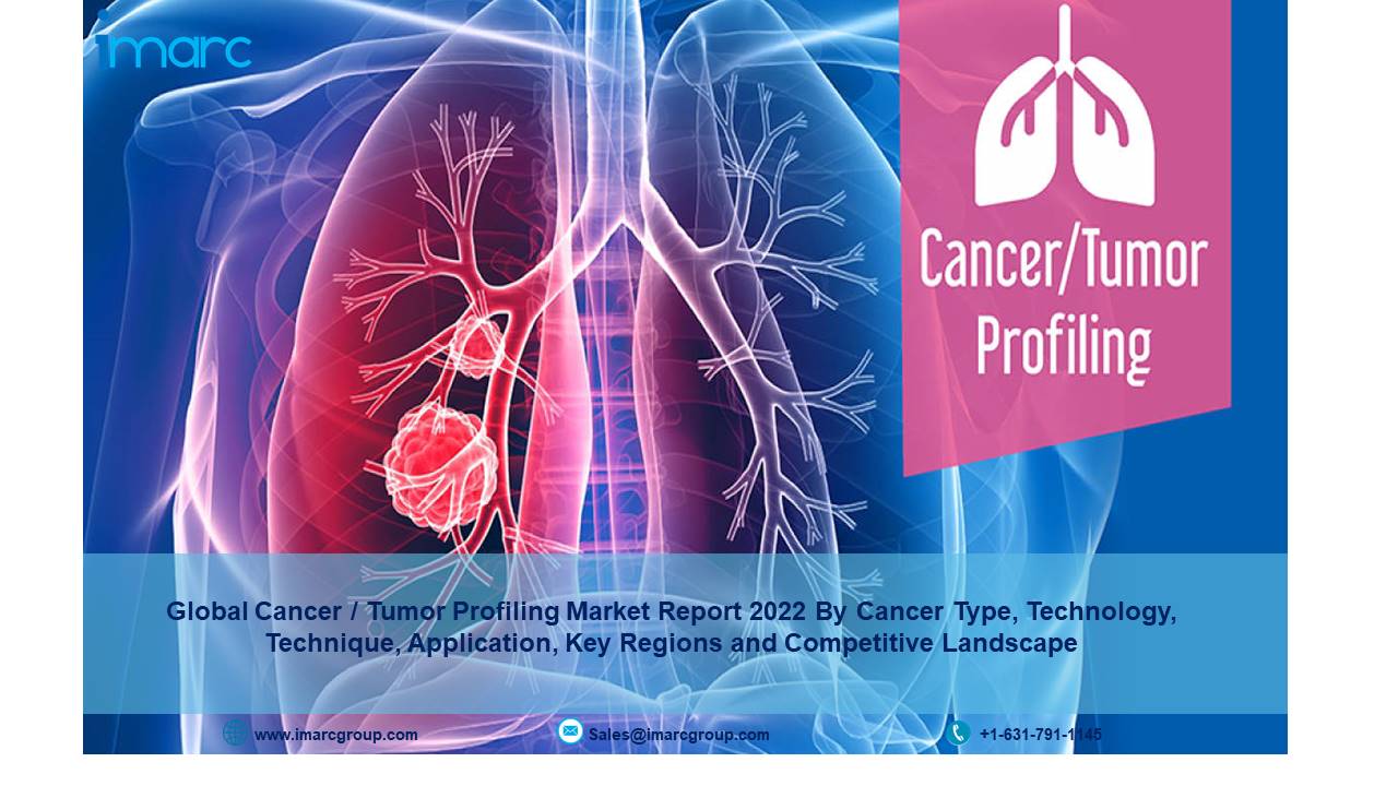 Cancer / Tumor Profiling Market Size, Share, Report, Global Demand, Growth, Opportunities and Forecast 2022-2027