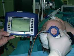 Intracranial Pressure Monitoring Market Analysis 2021-2026, Industry Size, Share, Trends and Forecast