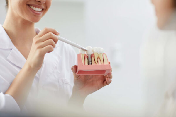 The Best Dental Implant Clinic in Dubai￼