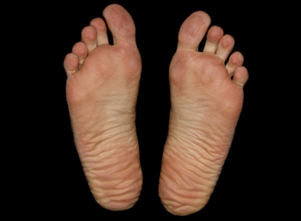 How to Prevent Foot Problems That Routinely Affect Your Feet