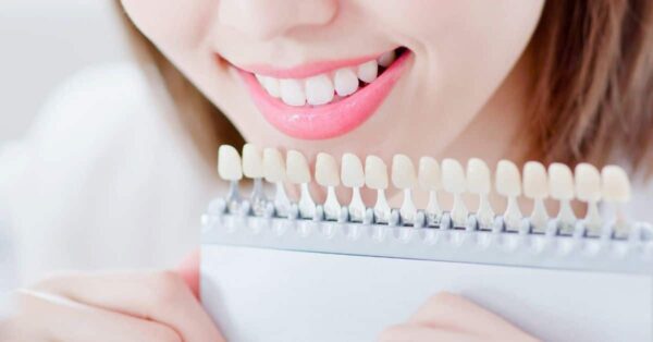 Best Tips to Take Care of Your Dental Veneers