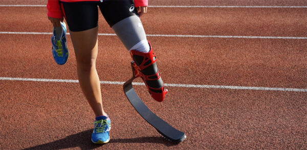 How Prosthetics Can Offer You More Freedom Towards A Quality Life?