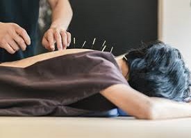 What follows after an acupuncture treatment?