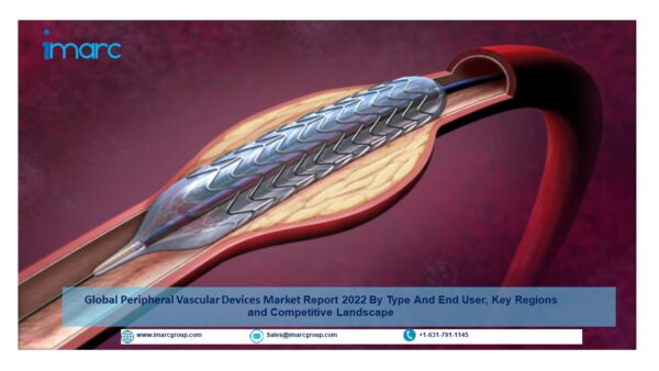 Peripheral Vascular Devices Market Size, Price Trends Analysis and Forecast to 2022-2027