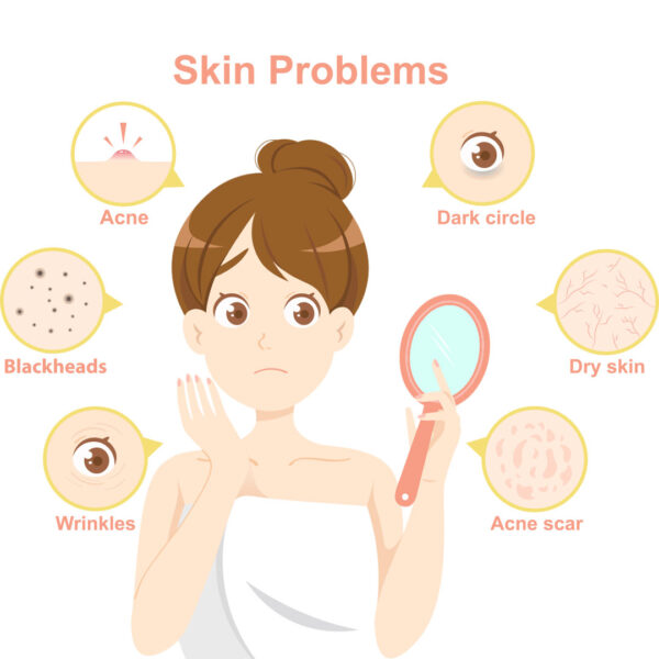 Skin Peel Treatment in UAE